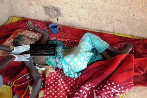 Les premières images des hospitalisés pour cause de malnutrition dans l’Est de la Mauritanie