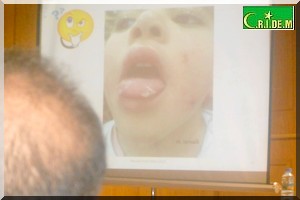 Santé : La dermatologie chez l’enfant passée en revue [PhotoReportage]