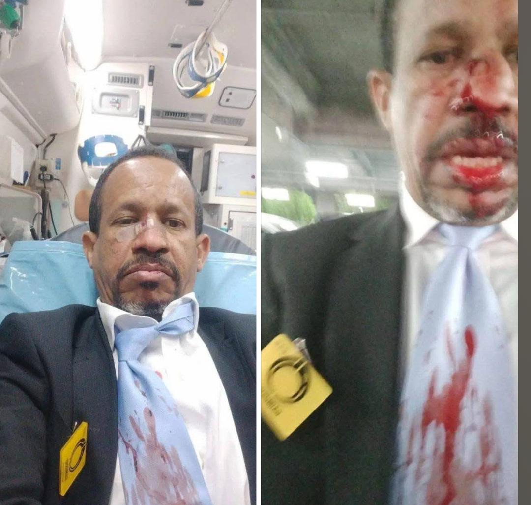 Deux diplomates mauritaniens impliqués dans une violente altercation à l’ambassade