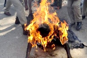  Nouackchott : Mort d'une Sénégalaise brûlée au 3e degré