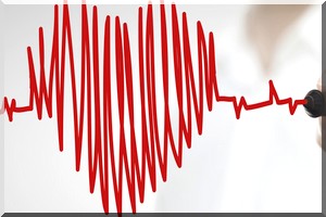 Santé/ L’infarctus, ce n’est pas seulement le cœur, le rein aussi