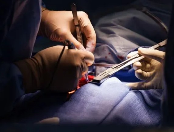 Indre-et-Loire : Des soignants s’envolent vers la Mauritanie pour opérer de jeunes enfants